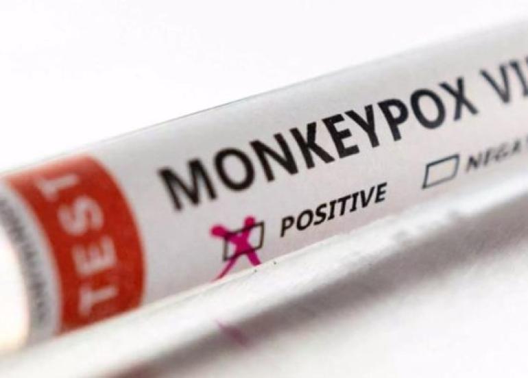 Ευλογιά των πιθήκων: «Έκρηξη» κρουσμάτων 660% – 5 χώρες στο κόκκινο – Η κατάσταση στην Ελλάδα