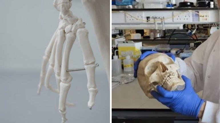 Επιστήμονες μετέτρεψαν μαλλί σε βιώσιμο υλικό για την αναγέννηση οστών