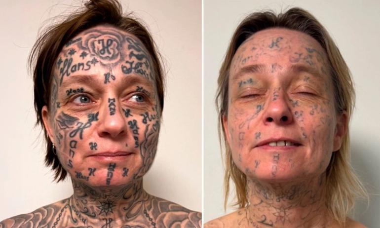 Ολλανδία: Έκανε τατουάζ 250 φορές το όνομά του στο σώμα της κοπέλας του