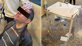 Εισβολή κουκουλοφόρων σε εκδήλωση στη Νομική - Στο νοσοκομείο διδακτορικός φοιτητής, τον χτύπησαν με πυροσβεστήρα